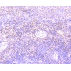 Anti-IL7 antibody [AH31-34]