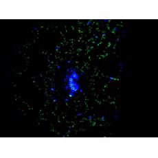 Anti-TGG2 antibody [6H1]