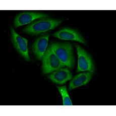 Anti-ASS1 antibody [11F1]