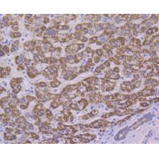 Anti-ALDH4A1 antibody [7E3]