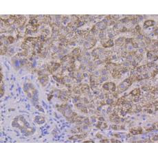 Anti-ALDH4A1 antibody [7E2]