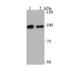 Anti-Glucocorticoid Receptor alpha antibody [3F2]
