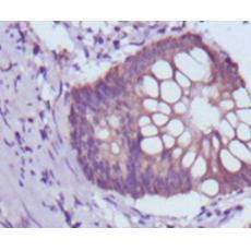 Anti-BDH1 antibody [C3-A5]