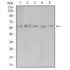 Anti-PAK3 antibody [F11-G8]