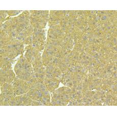 Anti-ALDH1A1 antibody [8F1]