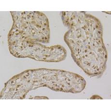Anti-MSH2 antibody [10G2]