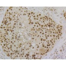 Anti-MSH2 antibody [10G1] 