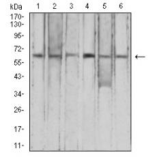 Anti-CFHR5 antibody