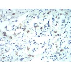 Anti-KPNA2 antibody