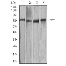Anti-MMP2 antibody [B11-E6]