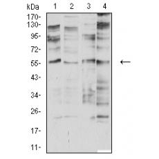 Anti-CHRNA2 antibody [H9-G12]