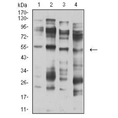 Anti-CHRNA5 antibody [D10-D2]