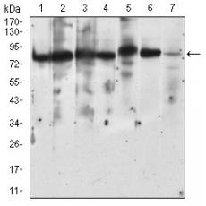 Anti-RPS6KA2 antibody [8C-4C]