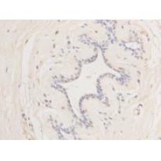 Anti-Cyclin E2 antibody [40-89]