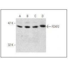 Anti-FOXF2 antibody [3G1]