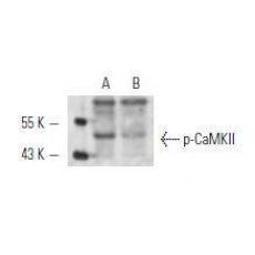 Anti-Phospho-CaMKII (Thr 286) antibody [2G1]