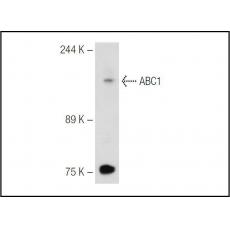 Anti-ABCA1 antibody [4G2]