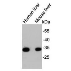 Anti-HADHSC antibody [D10-E7]