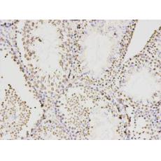Anti-KLHDC3 antibody [A8-E8]