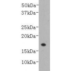 Anti-LT-alpha antibody [6-C10-10]
