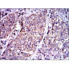 Anti-SERPINE1 antibody [H9-D5]