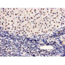 Anti-PGBD5 antibody [7-F8-5]