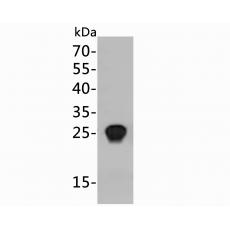 Anti-HIV1 p24 antibody [12G2]