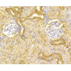 Anti-PLGF antibody [3G3]