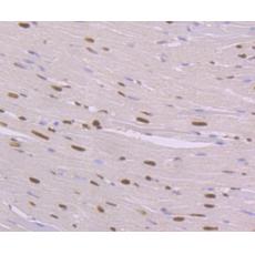 Anti-NFIB/NF1B2 antibody [1H1]