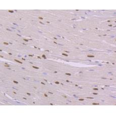 Anti-NFIB/NF1B2 antibody [1H1]