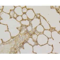 Anti-Osteoprotegerin antibody [9C1]