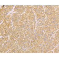 Anti-Osteoprotegerin antibody [9C2]