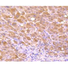 Anti-FGF21 antibody [AH21-71]