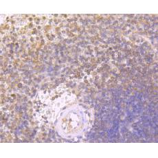 Anti-IL6 antibody [AH35-32]