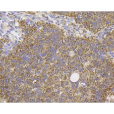 Anti-DAP Kinase 1 antibody [12B2]