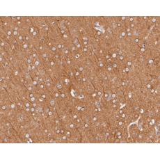 Anti-Dynamin 1 antibody [A1B1]