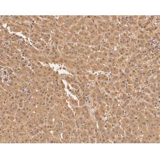 Anti-Aspartate Aminotransferase antibody [A2D7]
