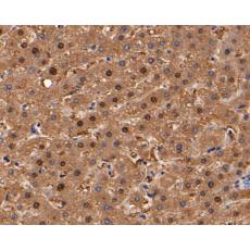 Anti-ACY1 antibody [15G2]