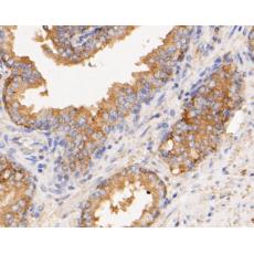 Anti-CASK antibody [A1C5]