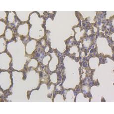 Anti-DAP Kinase 1 antibody [12B1]