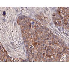 Anti-CD166 antibody [11-6]