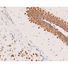 Anti-CELF2 antibody [D7-B5]