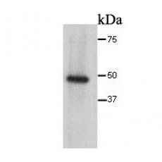 Anti-Cytokeratin 17 antibody [83-13]