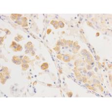 Anti-Cytokeratin 18 antibody [6-19]