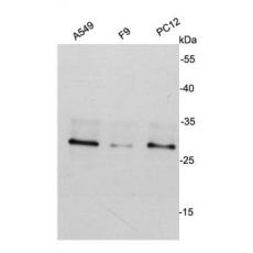 Anti-CDK2 antibody [10-D7]