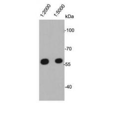 Anti-Vimentin antibody [A6-C1]