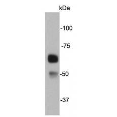 Anti-Catalase antibody [4-G10]