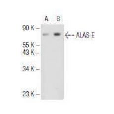 Anti-ALAS2 antibody [12-D]