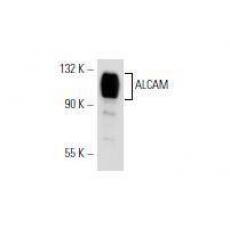 Anti-ALCAM/CD166 antibody [7C2]