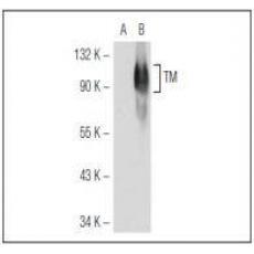 Anti-CD141 antibody [2G1]